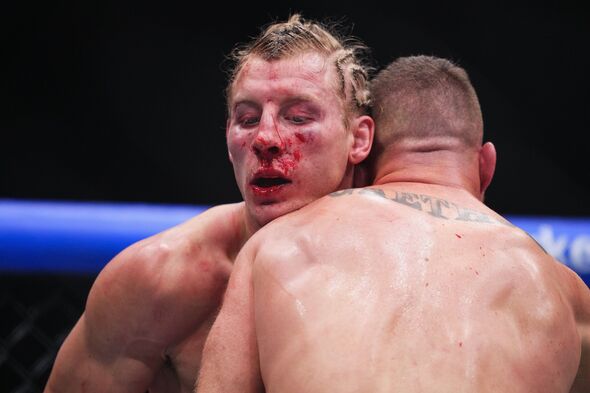 The man from Liverpool was left bloodied after the brutal five-round contest