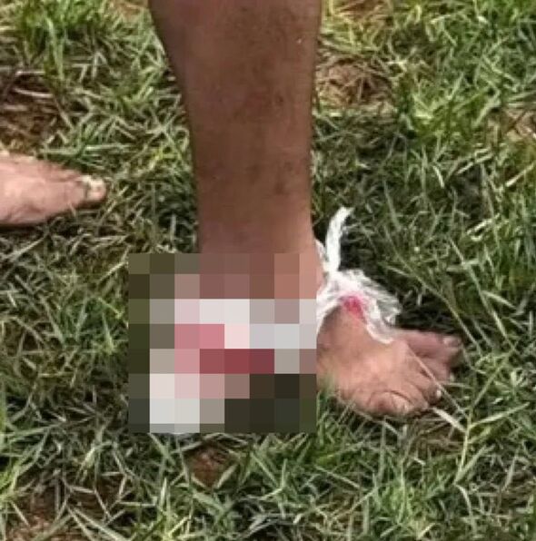 Piranha attack leaves people injured in Iaçu, and the city government is expected to close a section of the Paraguaçu River