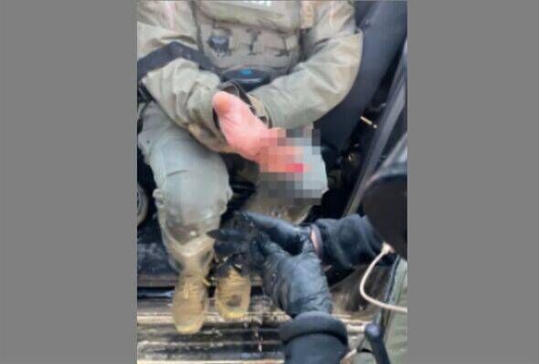 ICE agent tending to his finger