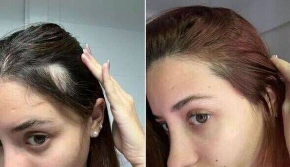 Shopper before and after using UKLASH Hair Growth Serum
