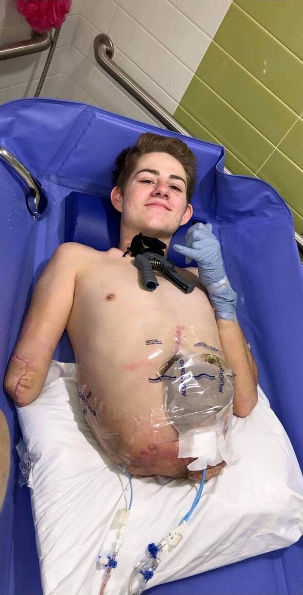 Loren Schauers in hospital after the accident