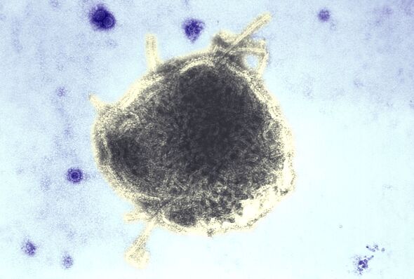 An electron microscope image showing the measles virus (large) and simian virus SV40 (small circles)