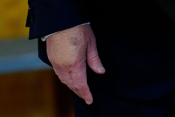 Trump hand